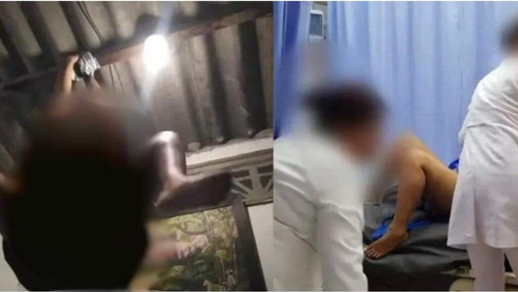 Mujer intentó hacer una peligrosa acrobacia sexual y terminó en un hospital