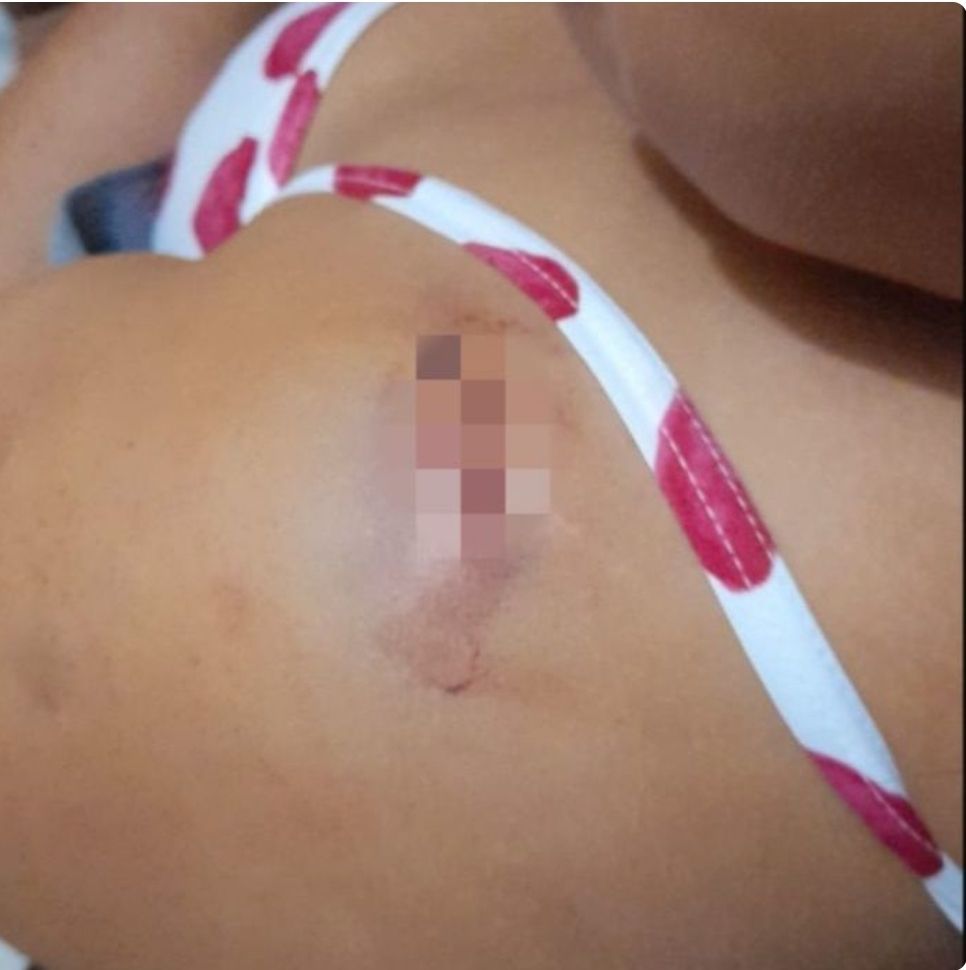 Mujer denuncia que su ex pareja la quiere matar