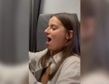 Bostezó que le desencajo la mandíbula