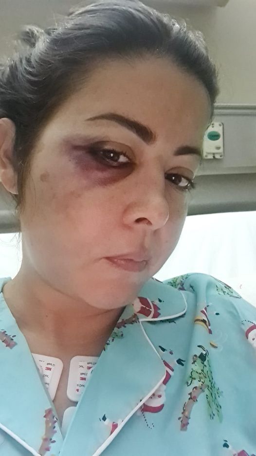 Someten a cirugía a Dafne Guzmán tras sufrir caída