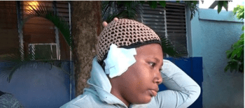 Mujer le arranca un pedazo de oreja a otra