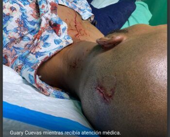 Limpiavidrios agrede reportero gráfico de RNN