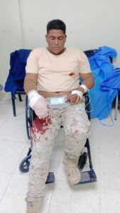 Haitianos hieren y despojan de escopeta a miembro de la FARD asignado a CESFronT