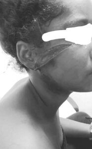 Niña desfigura el rostro a otra en Pedro Brand