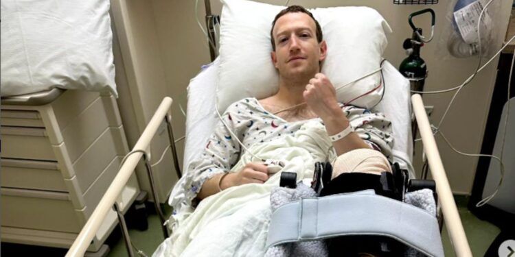 Mark Zuckerberg fue sometido a una cirugía