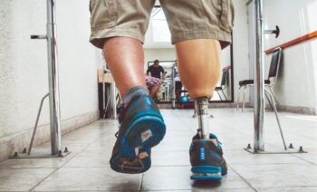 Desarrollan prótesis de pie y tobillo de bajo costo