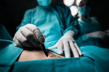 Revelan 93 personas muertas en EEUU tras realizarse cirugías estéticas en RD, desde 2009