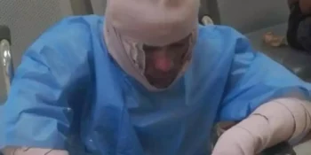 Continúa prófuga mujer que roció gasolina y prendió fuego a su pareja en Los Ríos