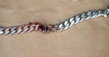 Hombre sobrevive a un disparo gracias a una cadena que llevaba puesta