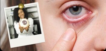 Advierten sobre consecuencias del calor para la vista