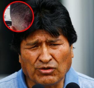 Hieren chofer de Evo Morales tras atentado