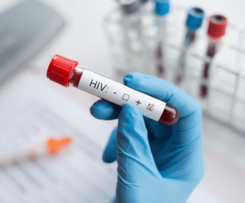 Denuncian alarmante discriminación laboral contra personas con VIH en RD