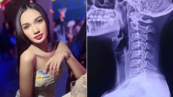 Muere cantante tailandesa tras sesión de masajes