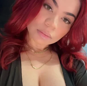 Muere joven tras realizarse varias cirugías estéticas con el doctor Edgar Contreras