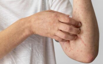 18 Señales De Advertencia Tempranas De Diabetes Que No Debes Ignorar