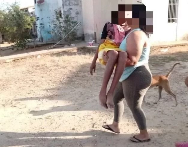 Niña de 12 años fue abusada sexualmente y quemada por su padrastro en Venezuela