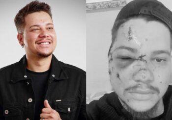 Hombre agrede con una botella a un artista durante concierto por «besar» a su esposa