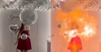 Sufre graves quemaduras en el rostro al explotarle un globo con helio