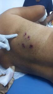 Atacan dominicano a tiros en Haití