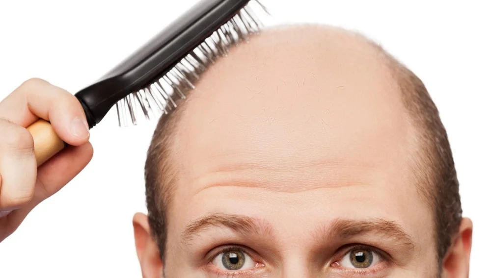 Trabajos que favorecen la caída del cabello, según un estudio