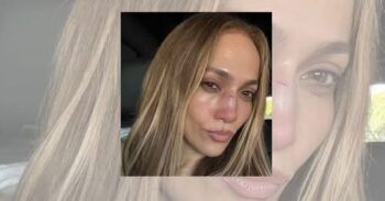 JLO sufre lesión en la cara tras accidente