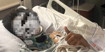 Rayo impactó a un adolescente durante tormenta en Nueva York