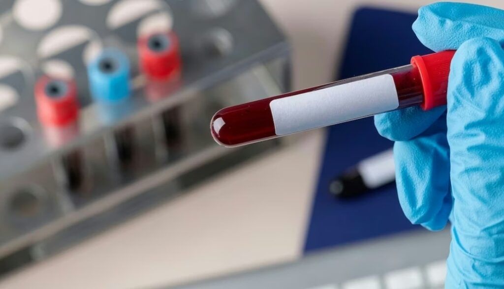 Japón comenzó a probar sangre artificial en humanos