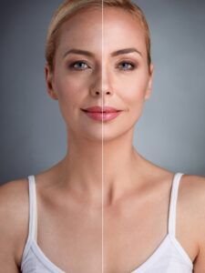 Tres alimentos que aceleran el envejecimiento de la piel