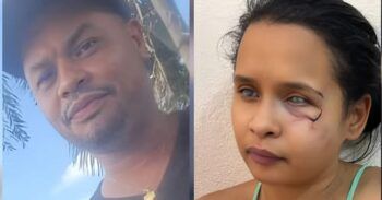 Continúa prófugo hombre que atacó brutalmente a pareja que quería separarse