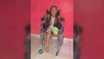 Reclaman justicia para niña que perdió pierna por un motorista calibrando