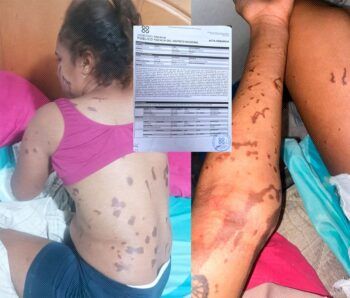 Quien lance ácido del diablo podría enfrentar 40 años de prisión