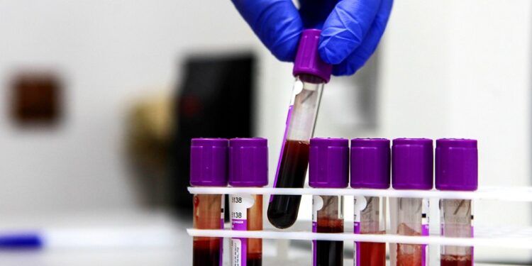 Inician en Rusia los primeros ensayos clínicos de una vacuna contra el cáncer