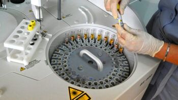 La vacuna rusa contra el cáncer está lista para su uso clínico
