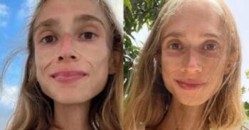 Muere joven por seguir dieta extrema de solo frutas