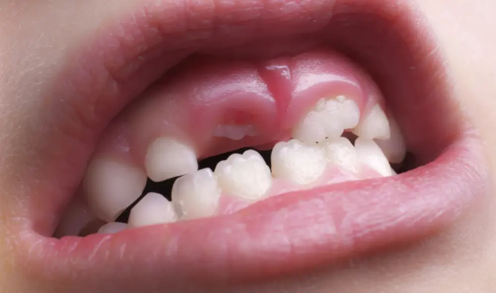 Crean medicamento capaz de regenerar dientes caídos