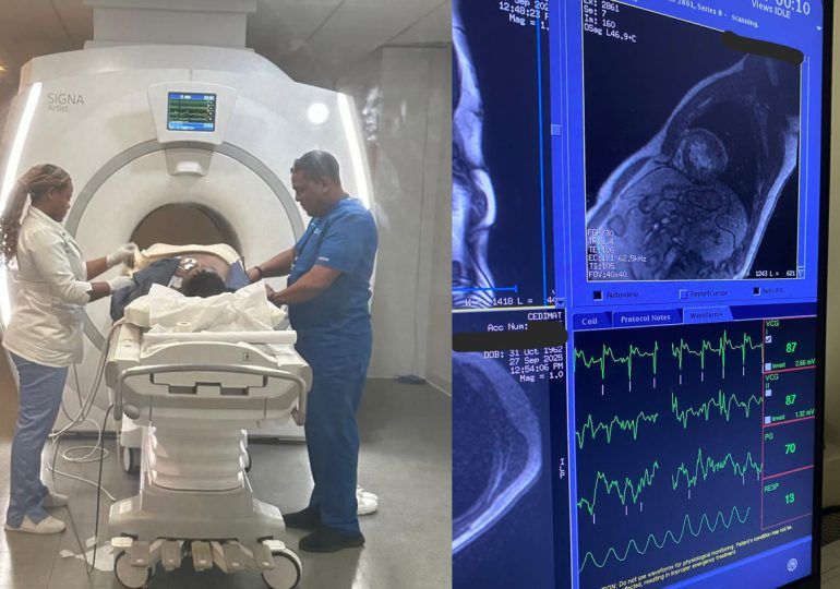 CEDIMAT realiza la primera resonancia cardíaca de estrés en el país
