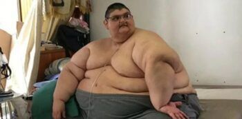 Muere el hombre más obeso del mundo