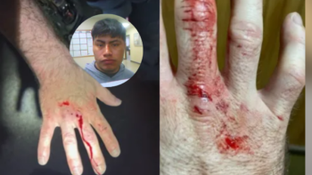 Inmigrante indocumentado, mordió la mano de un oficial de ICE