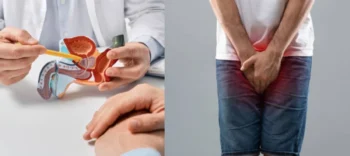 Eyacular con frecuencia reduce el riesgo de cáncer de próstata